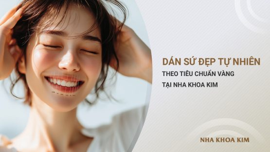 Dán sứ đẹp tự nhiên theo tiêu chuẩn vàng tại Nha Khoa Kim