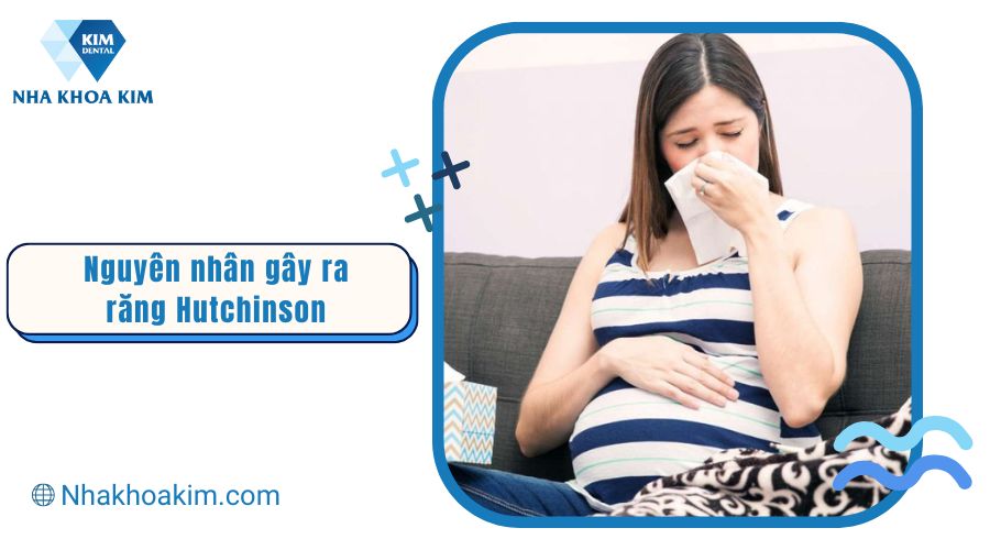 nguyên nhân gây ra Răng Hutchinson