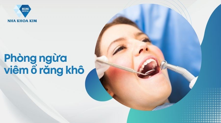 phòng ngừa viêm ổ răng khô