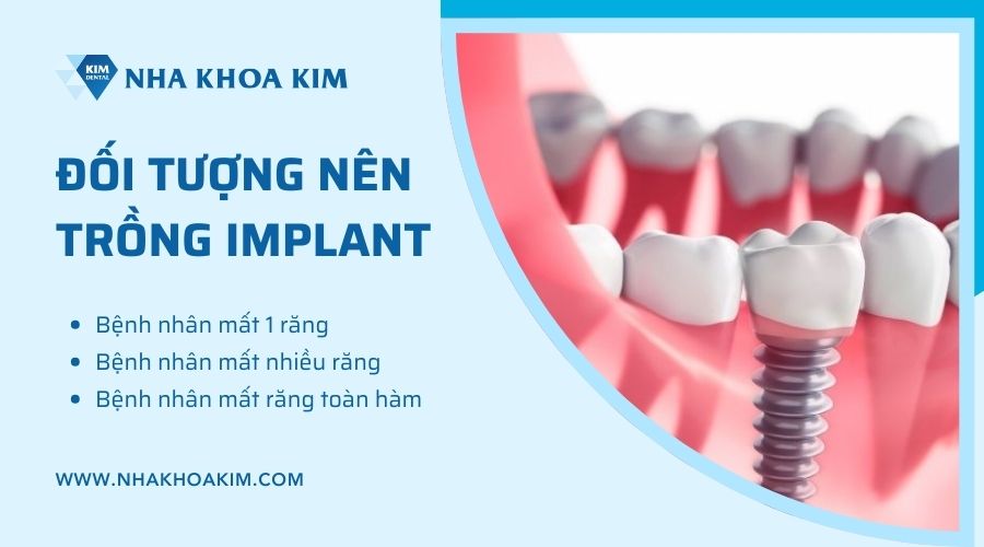 Đối tượng nên trồng implant