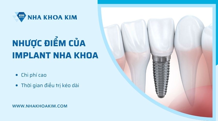 Những hạn chế của trồng implant nha khoa