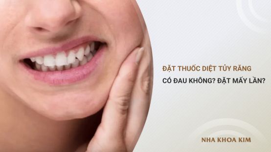Đặt thuốc diệt tủy răng có đau không? Đặt mấy lần?