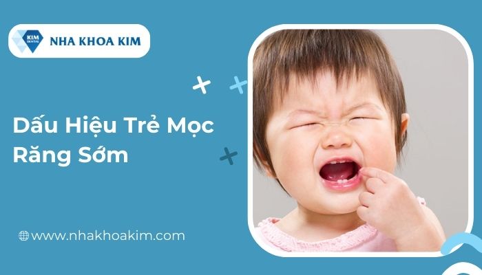 dấu hiệu trẻ mọc răng sớm