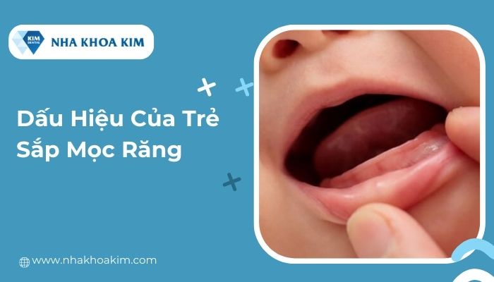 dấu hiệu trẻ sắp mọc răng