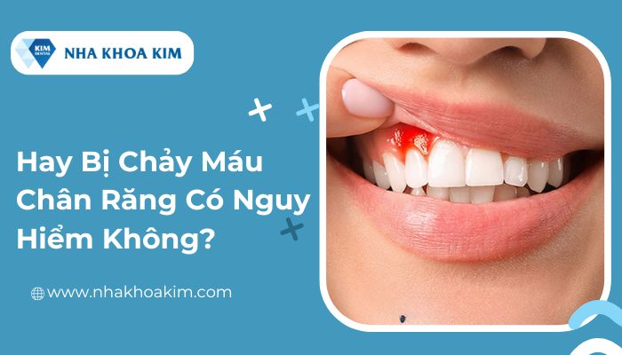 Hay bị chảy máu chân răng có nguy hiểm không