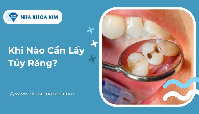 Khi nào cần lấy tủy răng?
