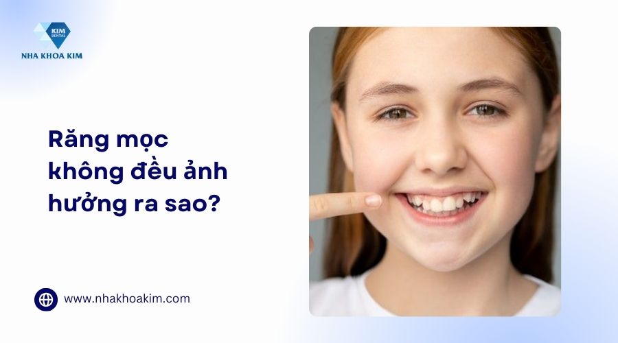 răng mọc không đều ảnh hưởng ra sao?