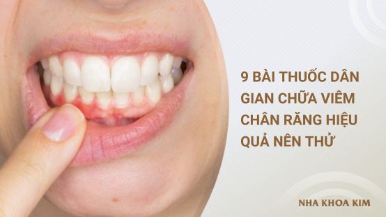 9 Bài thuốc dân gian chữa viêm chân răng hiệu quả nên thử