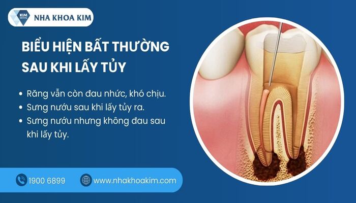 Biểu hiện bình thường và bất thường khi lấy tủy răng