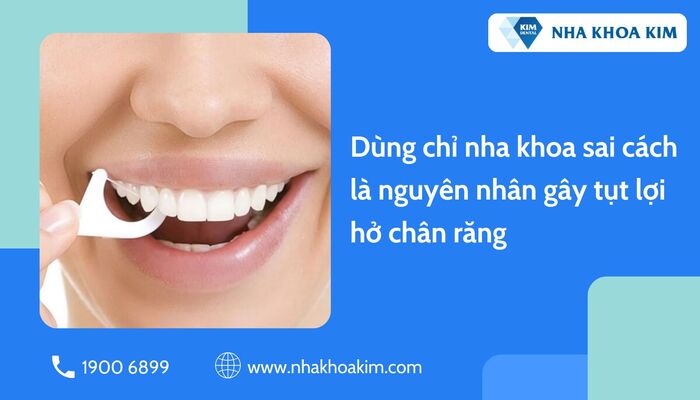 răng bị tụt lợi do dùng chỉ nha khoa sai cách
