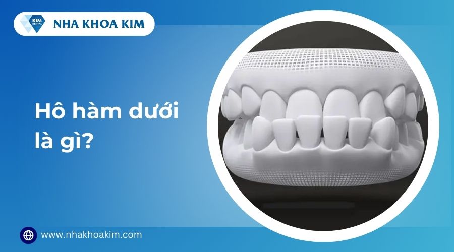 hô hàm dưới là gì