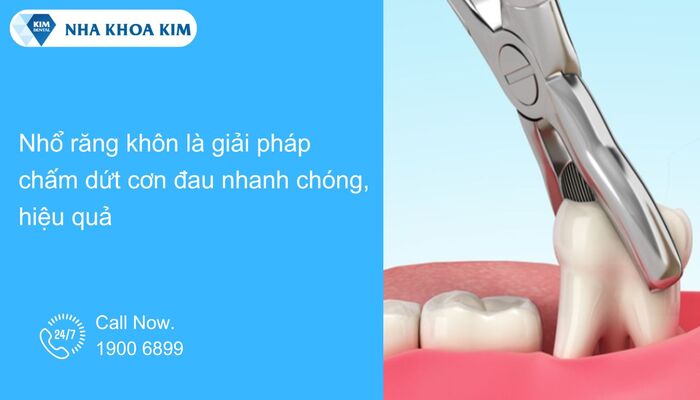 Nhổ răng khôn mọc bất thường