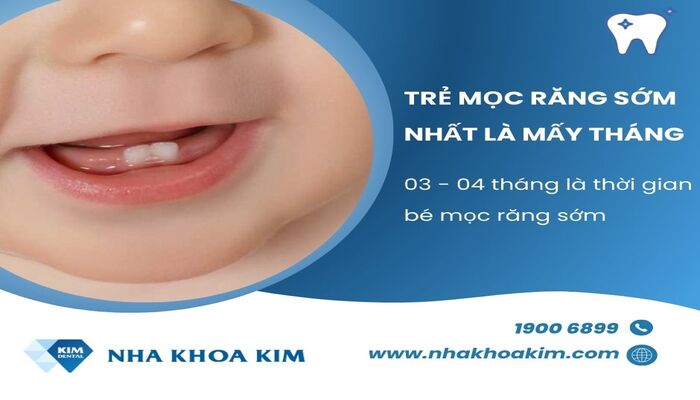 mấy tháng trẻ là mọc răng sớm