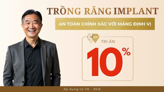 Tri ân 10% dịch vụ trồng răng Implant