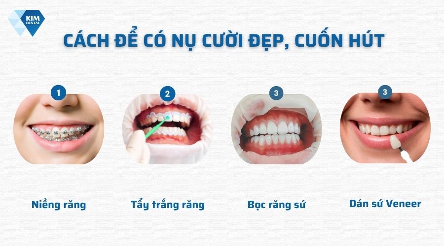 Cách để có nụ cười đẹp, cuốn hút