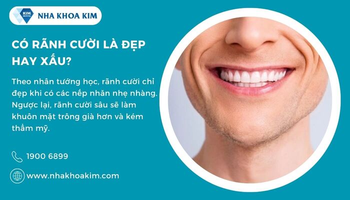 có rãnh cười là đẹp hay xấu