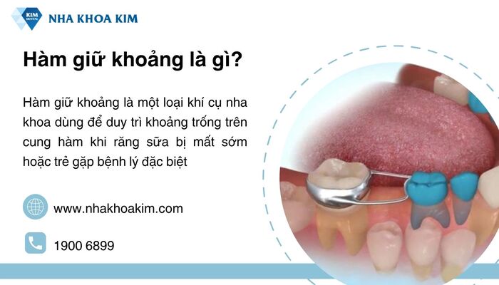hàm giữ khoảng là gì