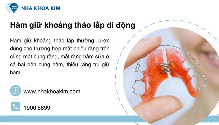 Hàm giữ khoảng tháo lắp