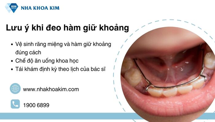 lưu ý khi đeo dụng cụ duy trì khoảng