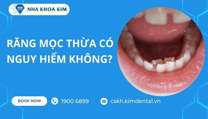 răng thừa có nguy hiểm không