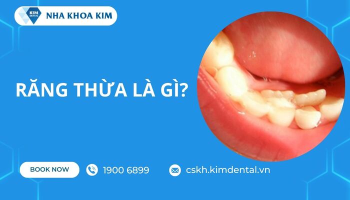 răng thừa là gì