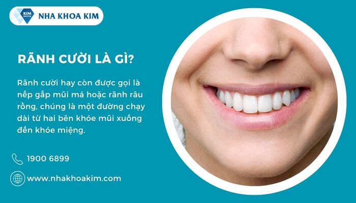 rãnh cười là gì