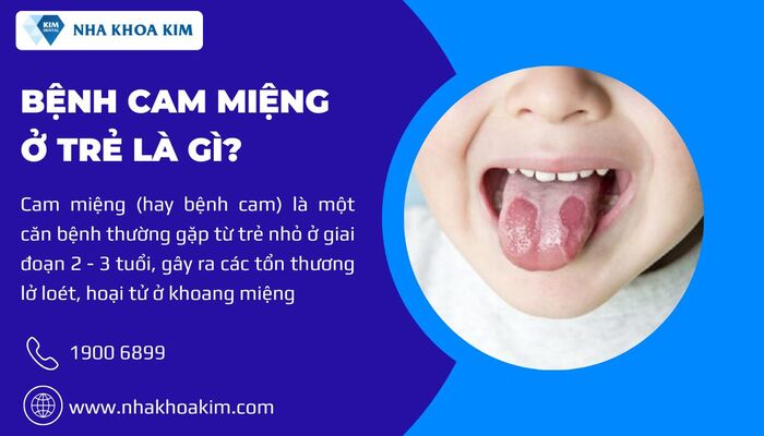 Bệnh cam miệng ở trẻ là gì?