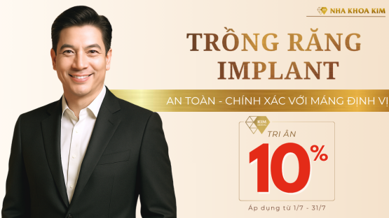 Tri ân 10% dịch vụ trồng răng Implant