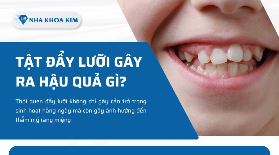 tác hại của đẩy lưỡi