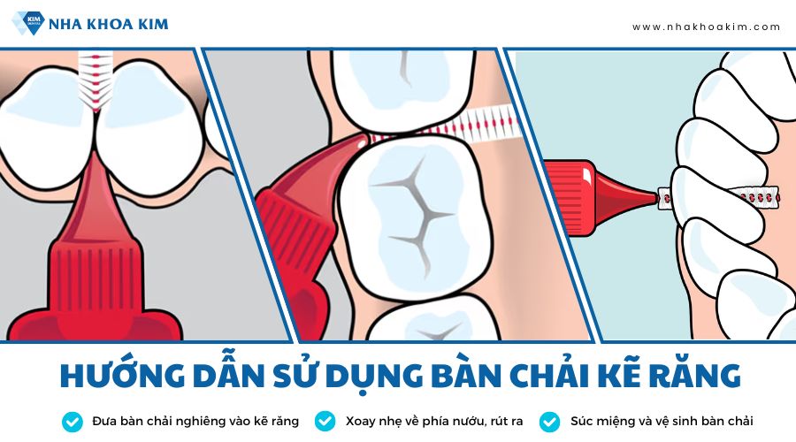 hướng dẫn sử dụng bàn chải kẽ