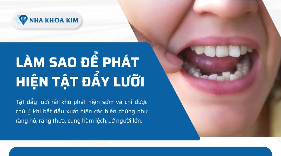 làm sao để phát hiện tật đẩy lưỡi