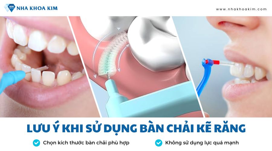 lưu ý khi sử dụng cây đánh kẽ răng