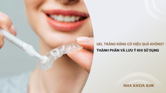 Gel trắng răng có hiệu quả không? Thành phần và lưu ý khi sử dụng