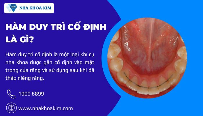 hàm duy trì cố định là gì