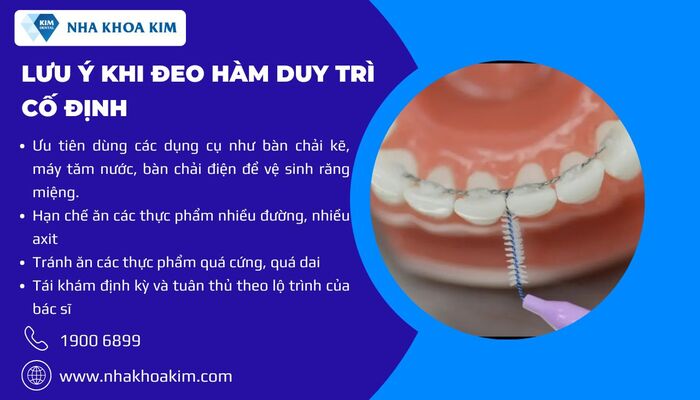 lưu ý khi đeo hàm duy trì