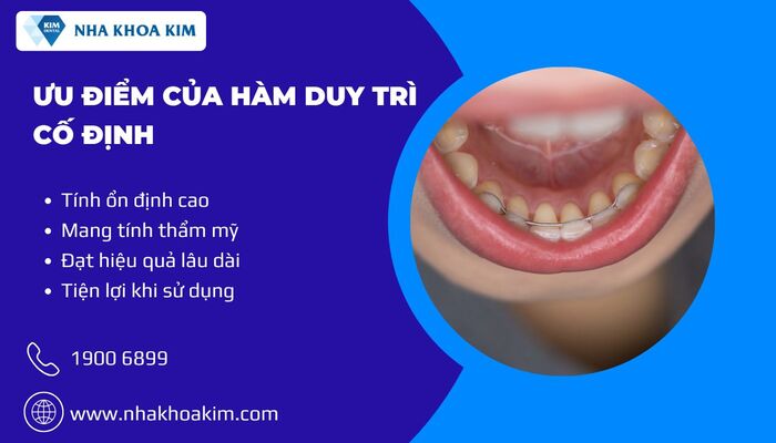 ưu điểm của hàm duy trì cố định