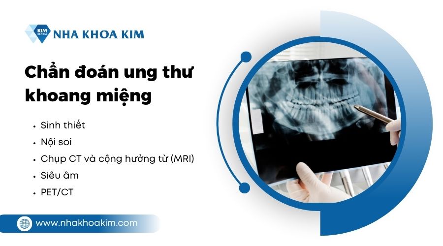 chẩn đoán bệnh ung thư miệng 