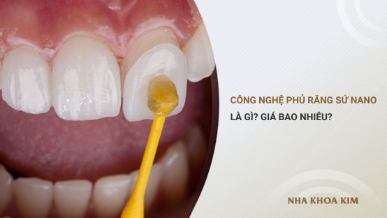 Công nghệ phủ răng sứ nano là gì? Giá bao nhiêu?