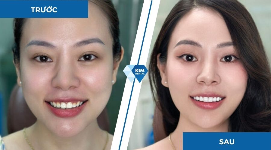 thay đổi bản thân là gì