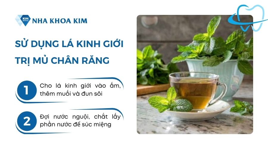 mẹo chữa viêm chân răng mủ trắng