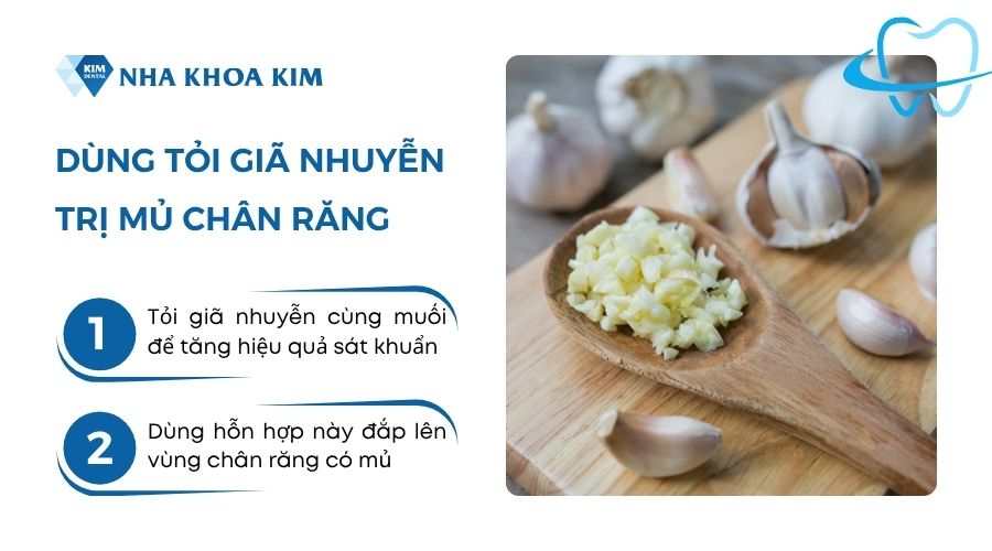 Mủ chân răng cách chữa bằng tỏi