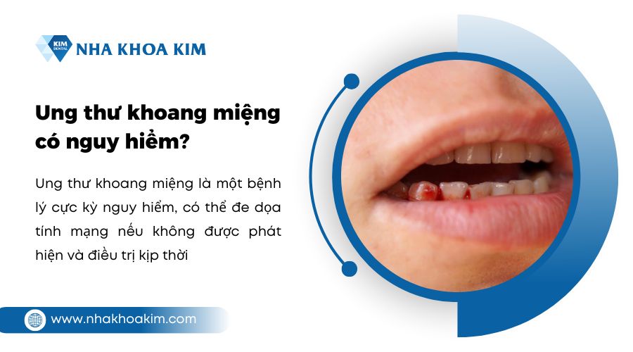 bệnh ung thư miệng có nguy hiểm không