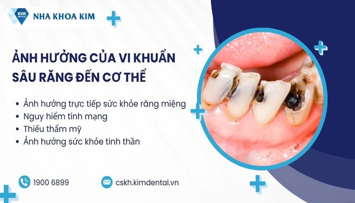 tác hại của vi khuẩn sâu răng