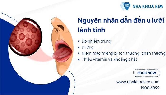 nguyên nhân gây u lưỡi lành tính