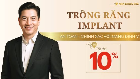 Tri ân 10% dịch vụ trồng răng Implant