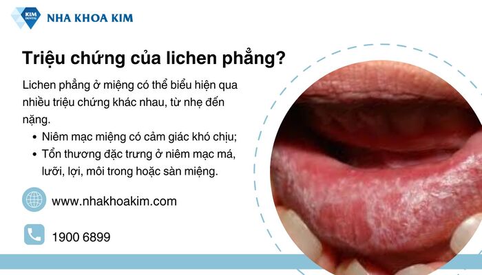 dấu hiệu của lichen phẳng