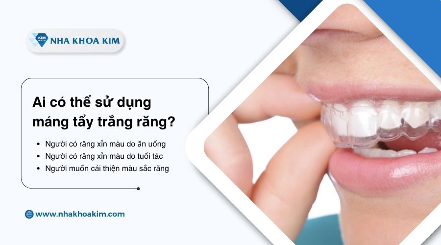 ai có thể dùng khay ngậm tẩy trắng