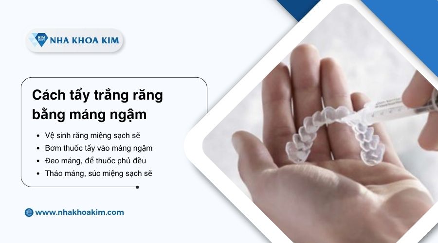 cách deo máng tẩy trắng răng