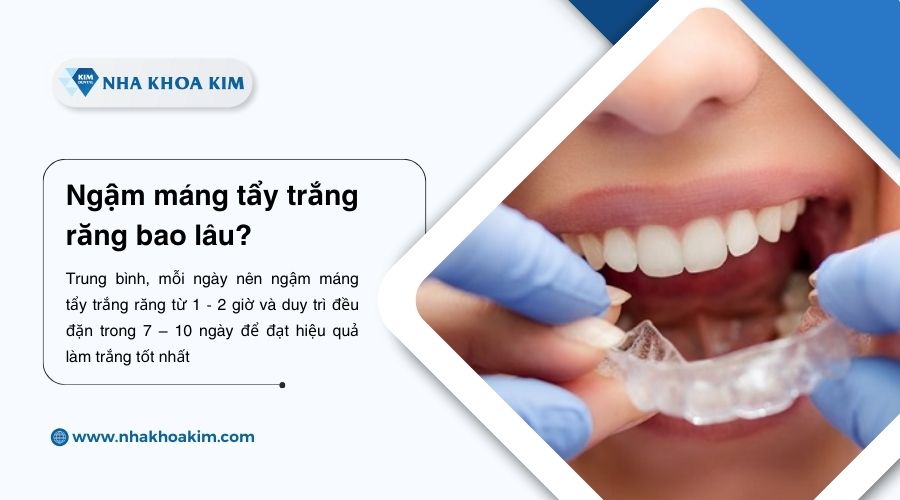 ngậm máng tẩy trắng răng bao lâu