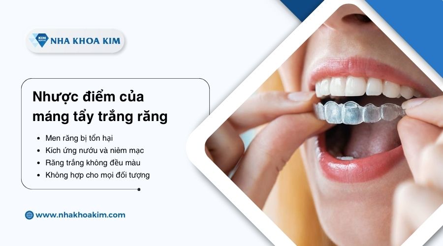 nhược điểm của máng tẩy trắng răng